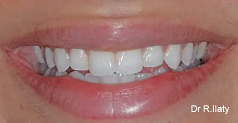 Before